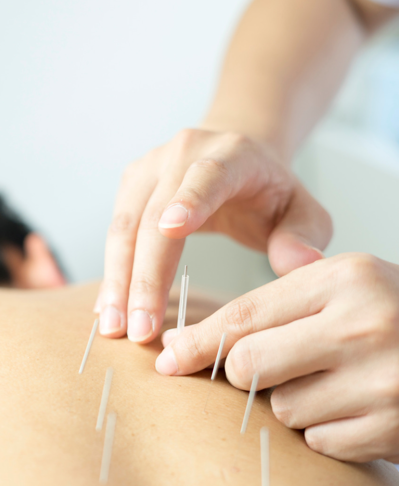 鍼灸マッサージを受ける患者様